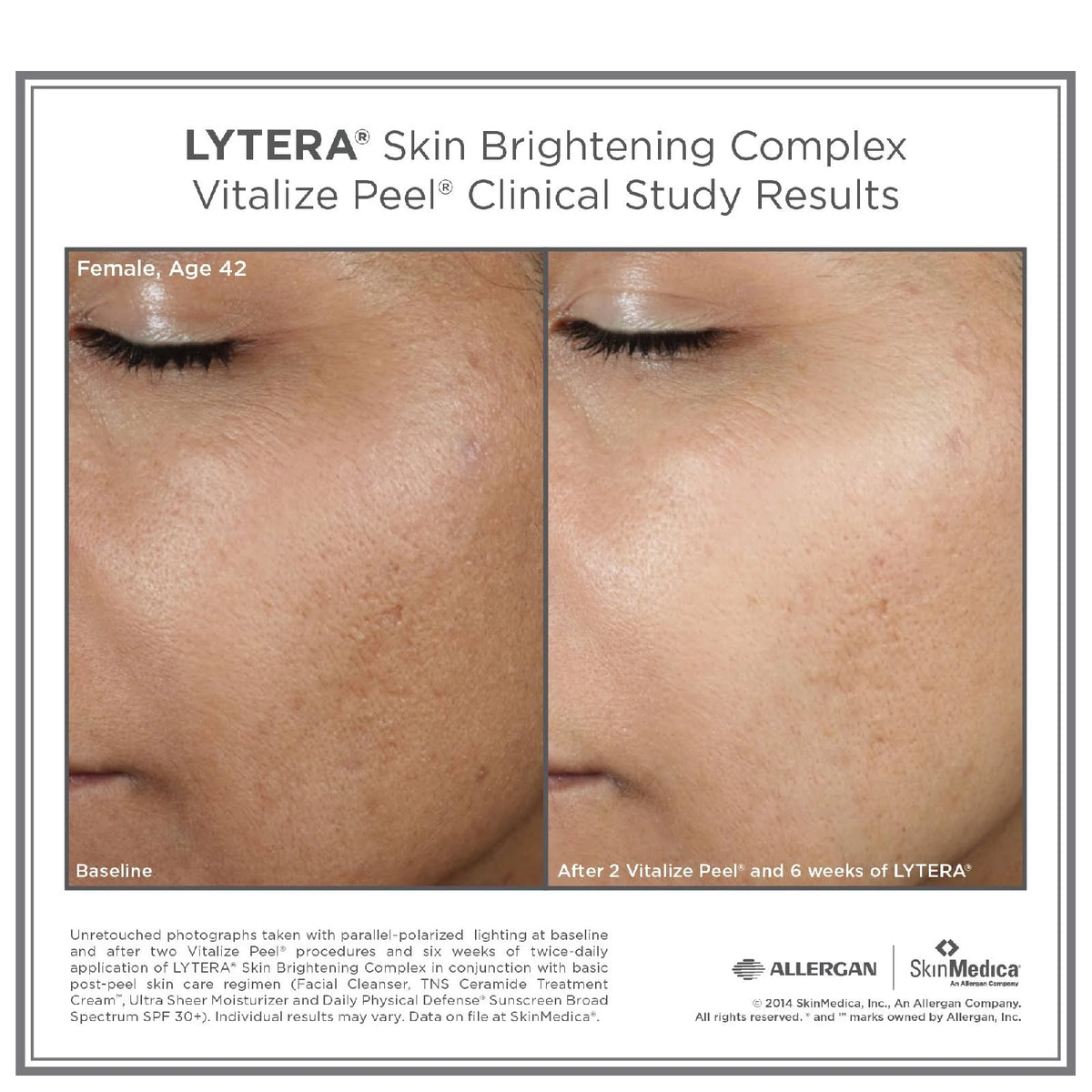 Skin Brightening Complex 2 oz C705