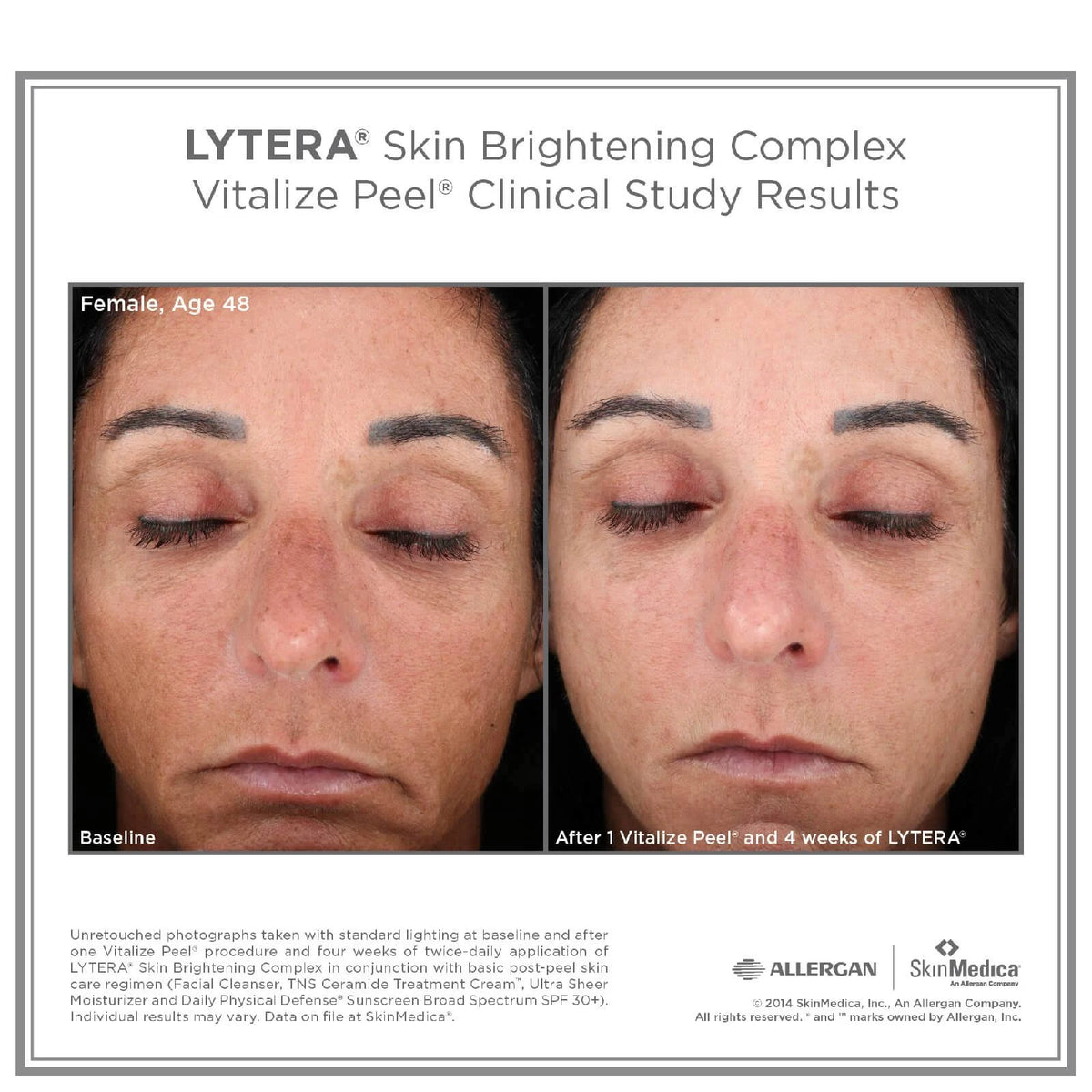 Skin Brightening Complex 2 oz C705