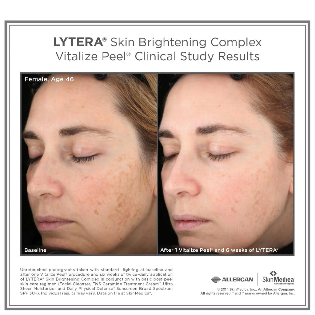 Skin Brightening Complex 2 oz C705