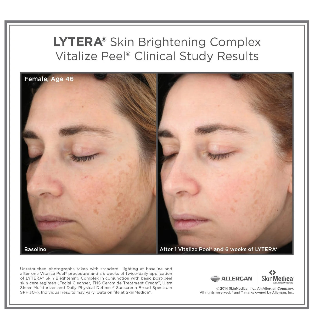 Skin Brightening Complex 2 oz C705